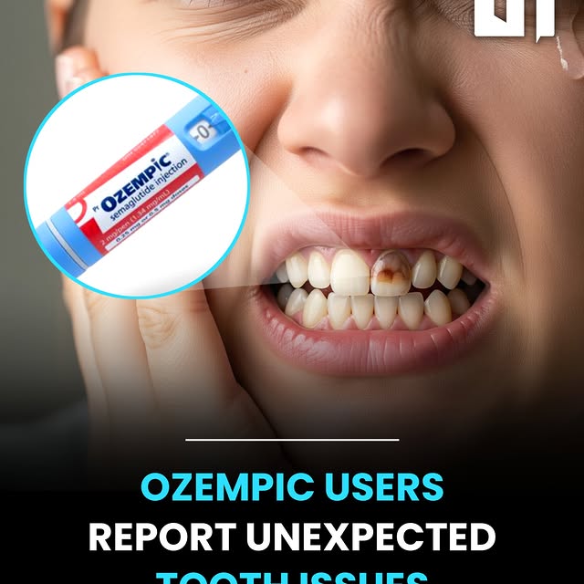 Post by mech.eng.world