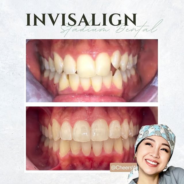 Post by cheerswithteresa