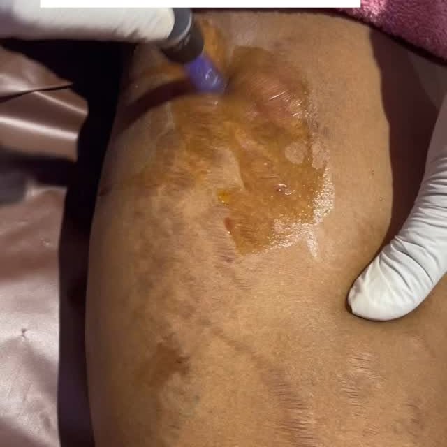 Post by thekittycare