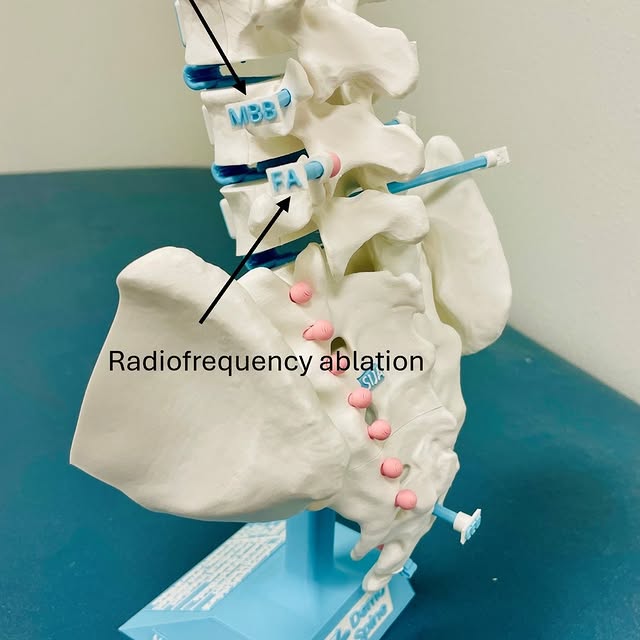 Post by nerve_and_pain_institute