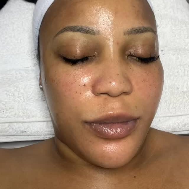 Post by alebeauteclinic