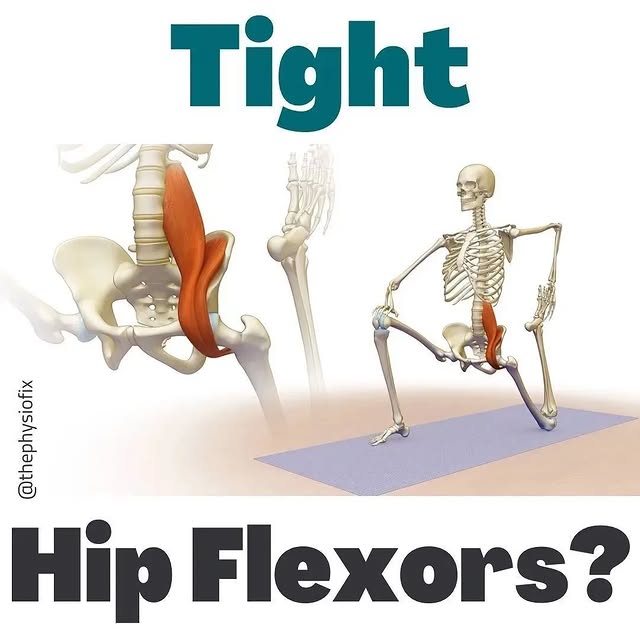 Post by fixforbackpain
