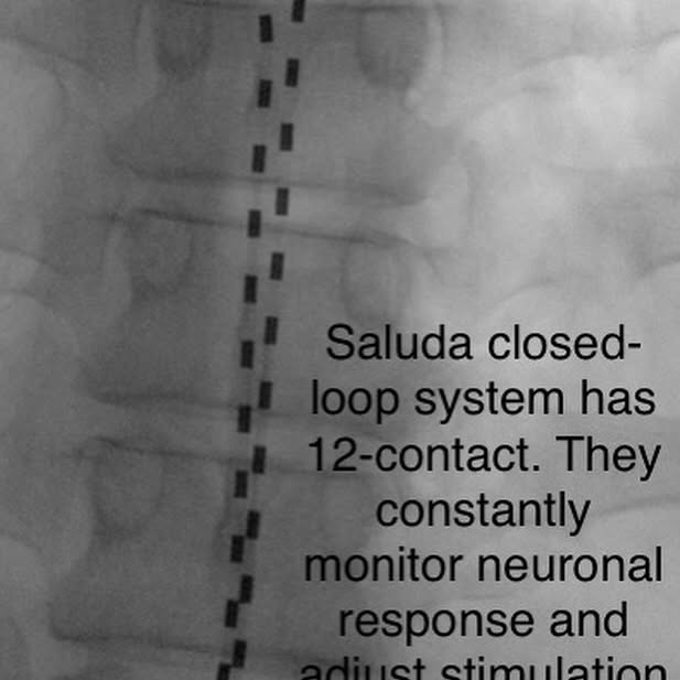 Post by nerve_and_pain_institute