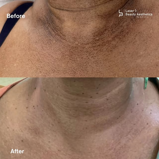 Post by laserandaestheticsbyshiela