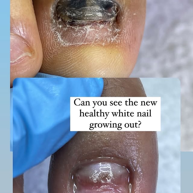 Post by flawlessestheticsclinic