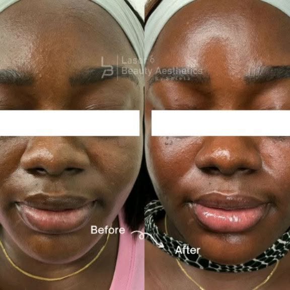 Post by laserandaestheticsbyshiela