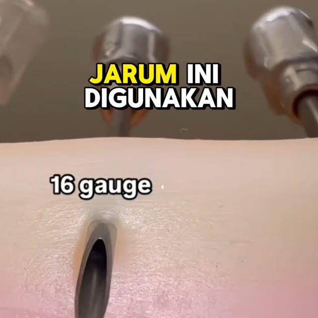 Post by giapratamamd