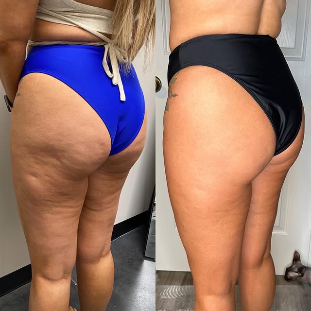 Post by brookeinjects_np