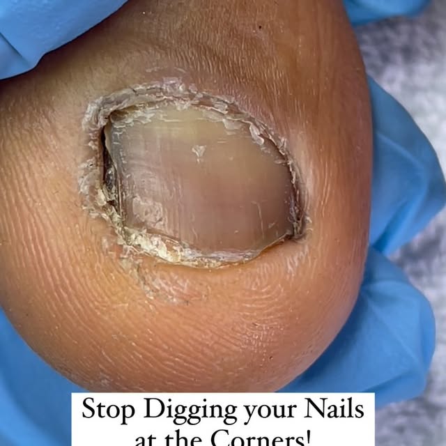 Post by flawlessestheticsclinic