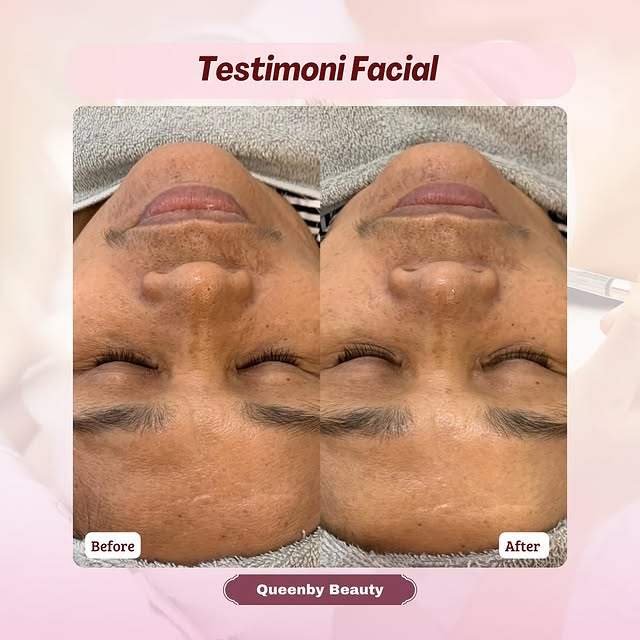 Post by queenby_beauty