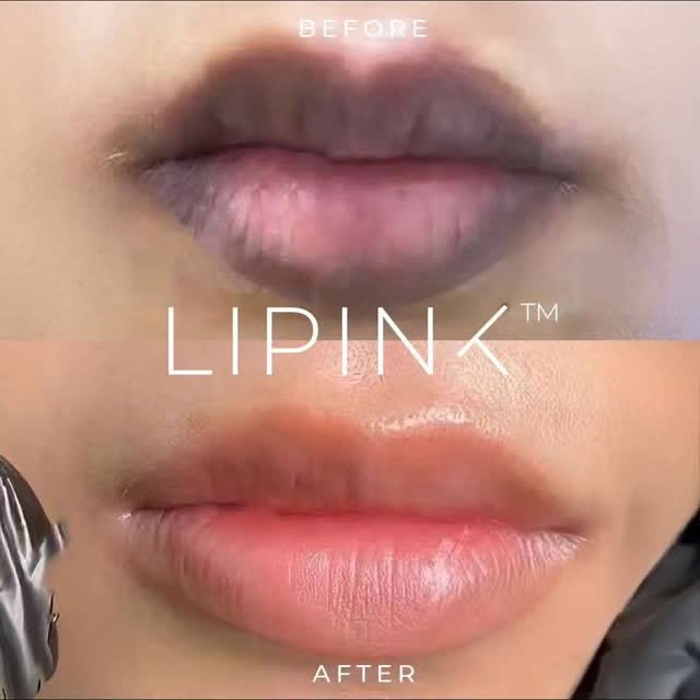 Post by onlyaestheticssg