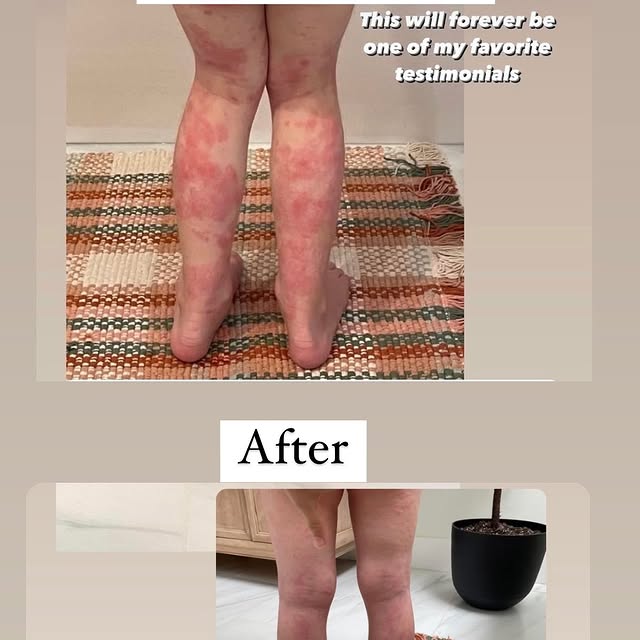 Post by holisticherbalmama