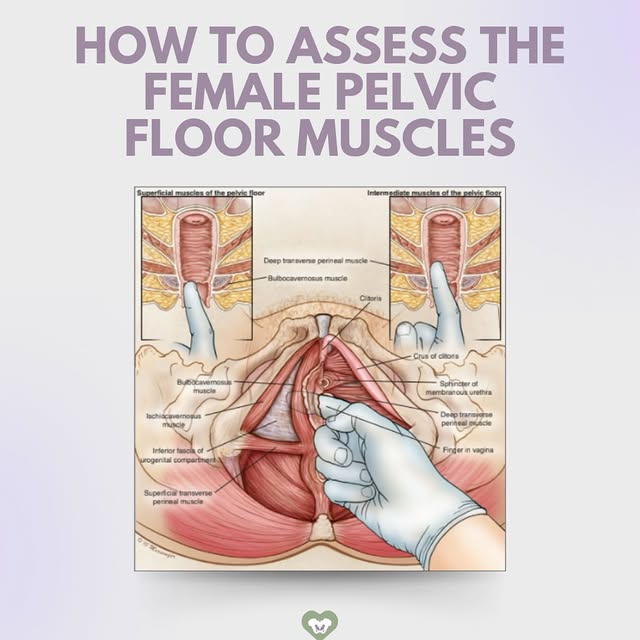 Post by pelvichealing