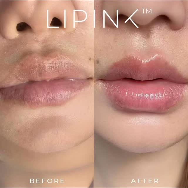 Post by onlyaestheticssg