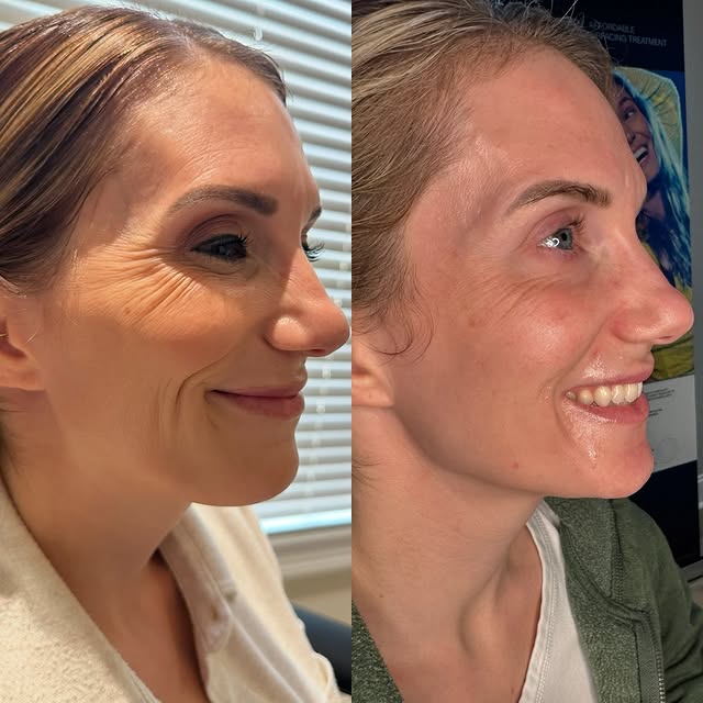 Post by brookeinjects_np