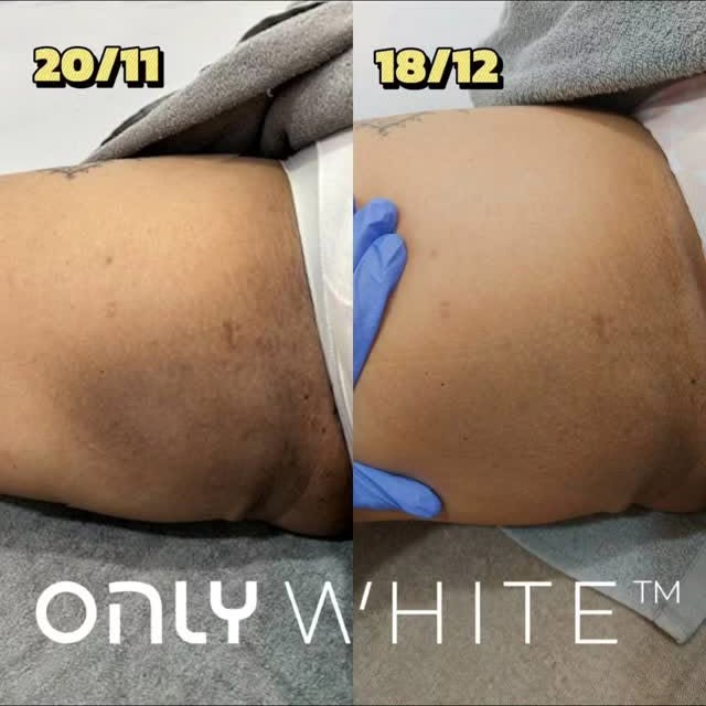 Post by onlyaestheticssg