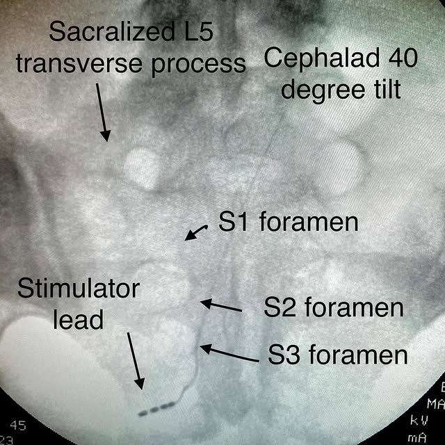 Post by nerve_and_pain_institute