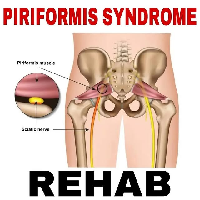 Post by fixforbackpain