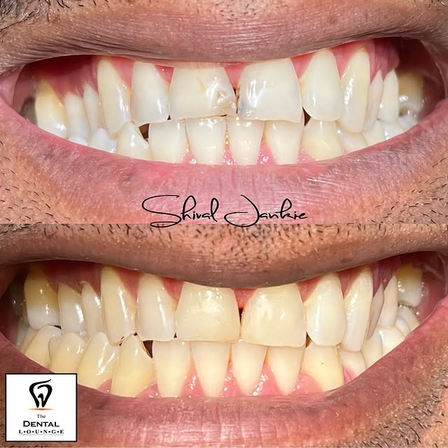 Post by dentloungett