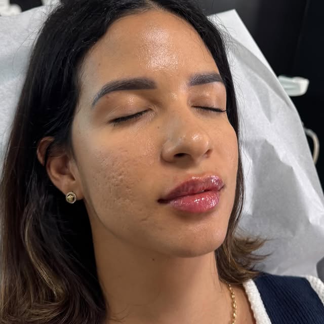 Post by newyoucosmeticcentres