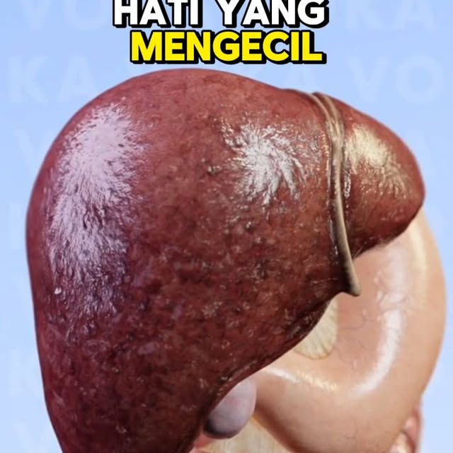 Post by giapratamamd