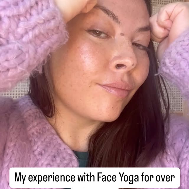 Post by theholisticfacelift