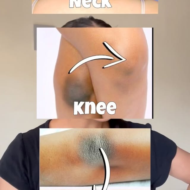 Post by healthy_tipswithme