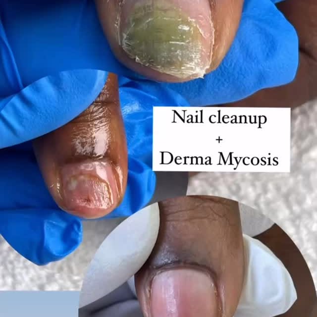 Post by flawlessestheticsclinic