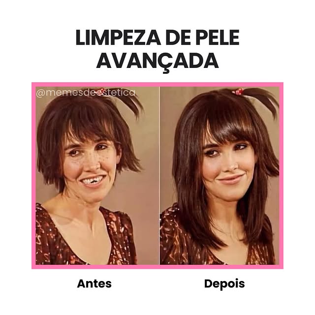 Post by memesdeestetica