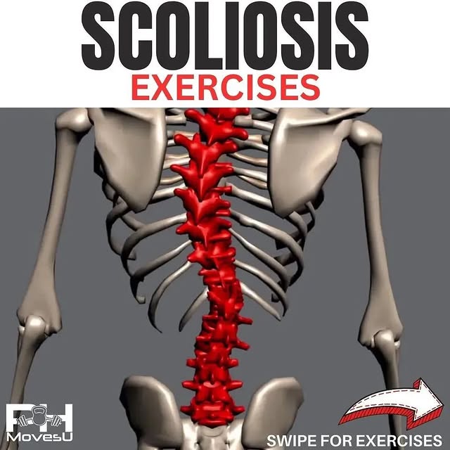 Post by fixforbackpain