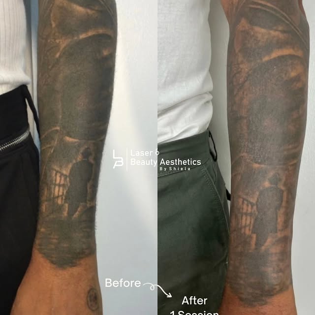 Post by laserandaestheticsbyshiela