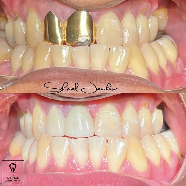 Post by dentloungett