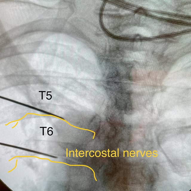 Post by nerve_and_pain_institute