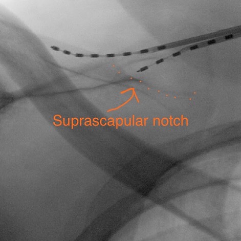 Post by nerve_and_pain_institute