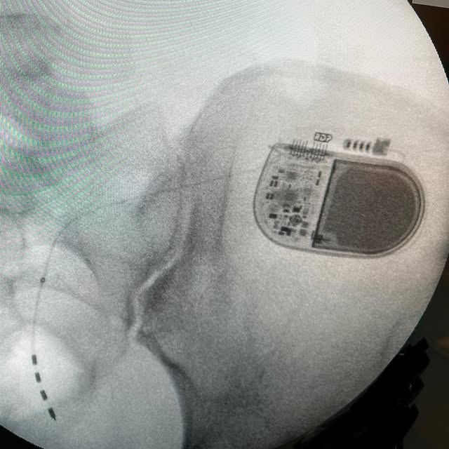 Post by nerve_and_pain_institute