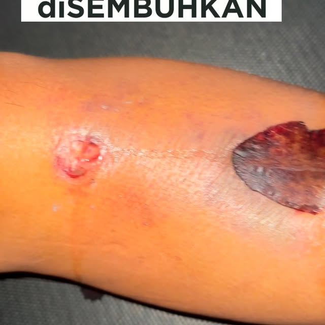 Post by dr.doddyrizqi