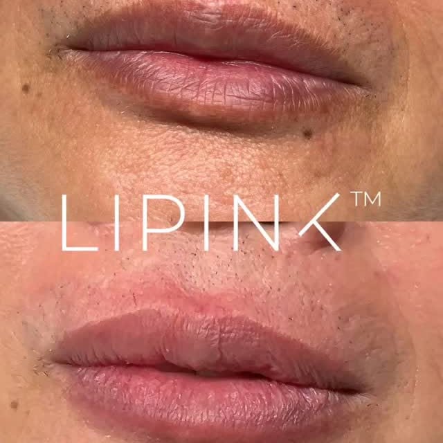 Post by onlyaestheticssg