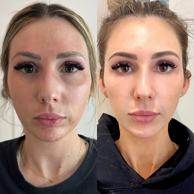 Post by brookeinjects_np