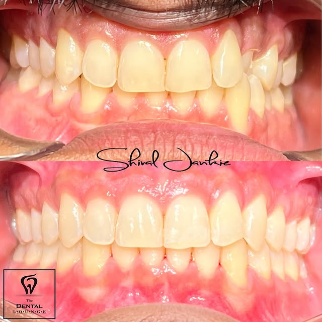 Post by dentloungett