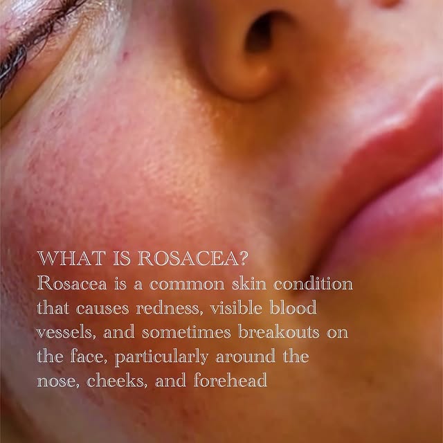 Post by your_esty_jama