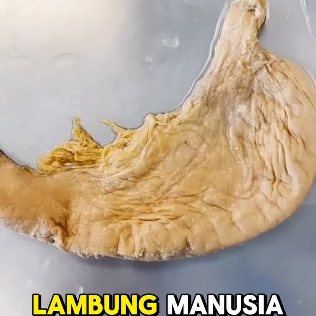 Post by giapratamamd