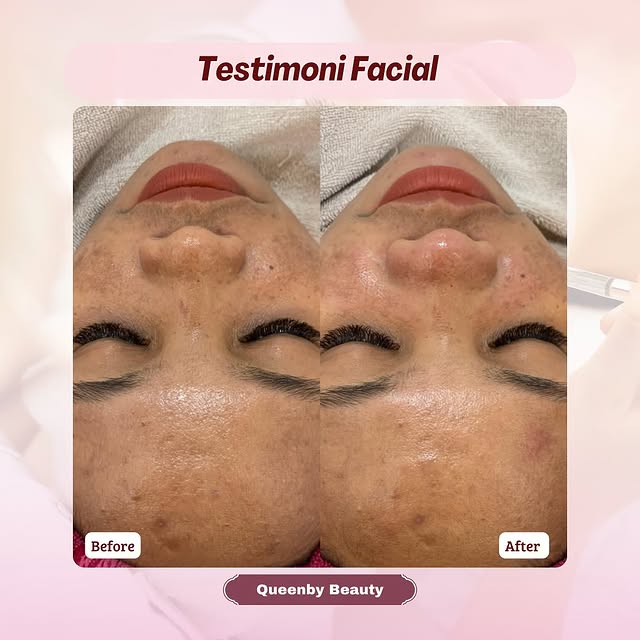 Post by queenby_beauty