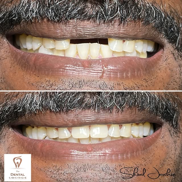 Post by dentloungett